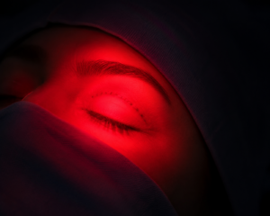 fotobiomodulação blefaroplastia